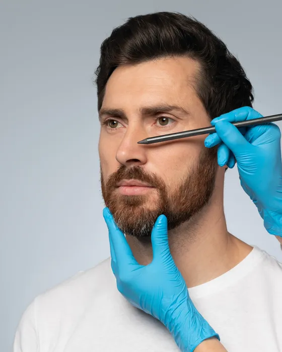 Gloved hands working on a patient's beard with fine forceps