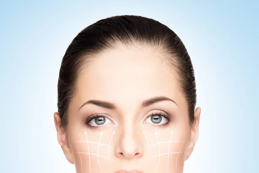 A face marked with contour lines showing the direction of lift