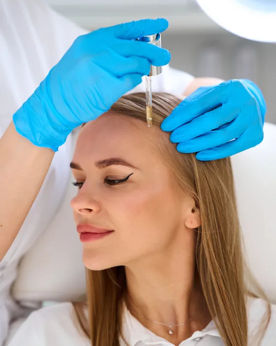 PRP Meso Hair treatment being prepared and injected into the scalp